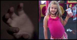 Her Daughter Fell 30 Feet Into A Hollow Tree. Then Her Mom Noticed Something Different About Her Stomach Her Daughter Fell 30 Feet Into A Hollow Tree. Then Her Mom Noticed Something Different About Her Stomach