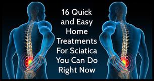 16 Quick and Easy Home Treatments For Sciatica You Can Do Right Now 16 Quick and Easy Home Treatments For Sciatica You Can Do Right Now