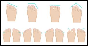 The Shape Of Your Feet Can Reveal Something Fascinating About Your Personality The Shape Of Your Feet Can Reveal Something Fascinating About Your Personality