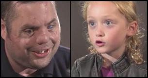 Little Girl Meets Disfigured Veteran, Leaves Him Struggling To Hold Back Tears Little Girl Meets Disfigured Veteran, Leaves Him Struggling To Hold Back Tears
