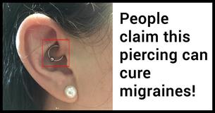 This Special Piercing Is Used As A New Remedy To Treat Chronic Migraines This Special Piercing Is Used As A New Remedy To Treat Chronic Migraines