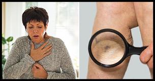 10 Ways To Identify A Blood Clot Early 10 Ways To Identify A Blood Clot Early