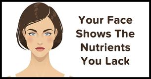 5 Ways You Can Tell If You Have Nutrient Deficiencies That Are Written All Over Your Face 5 Ways You Can Tell If You Have Nutrient Deficiencies That Are Written All Over Your Face