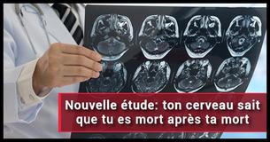 Une étude terrifiante révèle que nos cerveaux sont conscients d'eux-mêmes après notre mort Une étude terrifiante révèle que nos cerveaux sont conscients d'eux-mêmes après notre mort