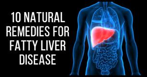 10 Natural Remedies For Fatty Liver Disease That You NEED To Know 10 Natural Remedies For Fatty Liver Disease That You NEED To Know