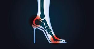 4 High Heel Hacks You Wish You Learned Long Ago 4 High Heel Hacks You Wish You Learned Long Ago