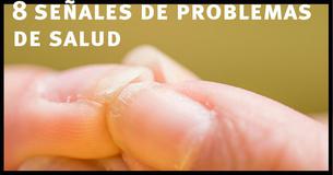 8 señales de problemas de salud que puedes detectar en las uñas 8 señales de problemas de salud que puedes detectar en las uñas