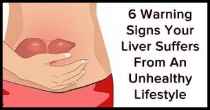 6 Signs An Unhealthy Lifestyle Is Affecting Your Liver 6 Signs An Unhealthy Lifestyle Is Affecting Your Liver