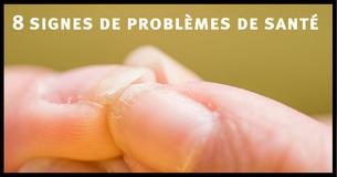 8 signes de problèmes de santé que tu peux identifier sur tes ongles 8 signes de problèmes de santé que tu peux identifier sur tes ongles
