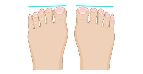 The Shape Of Your Feet Can Reveal Something Fascinating About Your ...