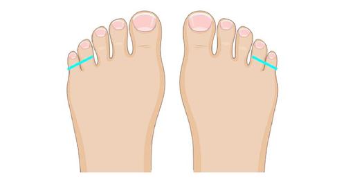 The Shape Of Your Feet Can Reveal Something Fascinating About Your ...