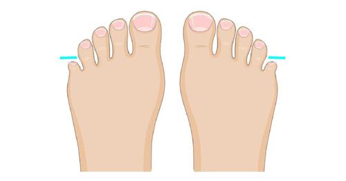 The Shape Of Your Feet Can Reveal Something Fascinating About Your ...