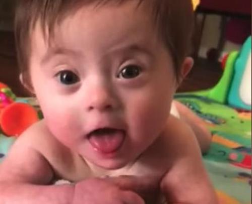 Un Bebe Trisomique Est Devenu Populaire Apres Avoir Montre Son Nouveau Sourire A Sa Mere Adoptive